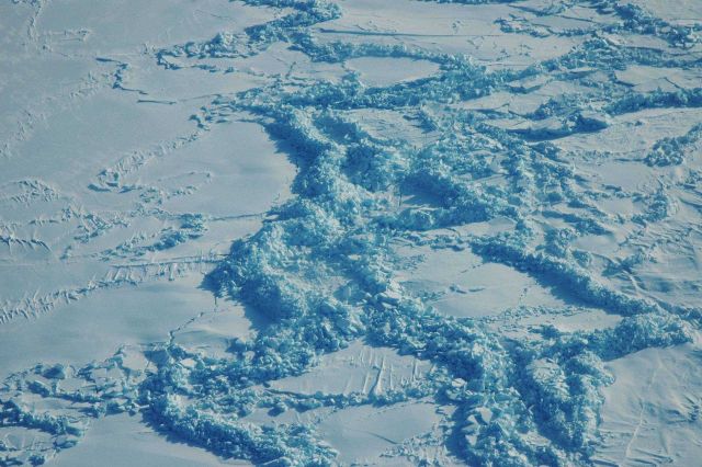A significant pressure ridge formation Picture