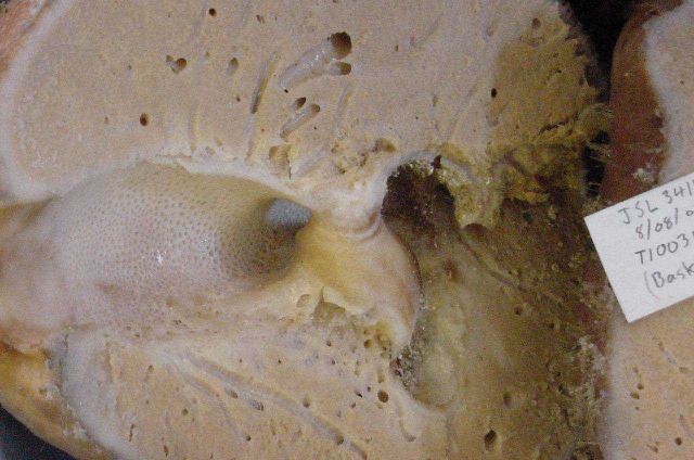 Charleston Bump Expedition Picture