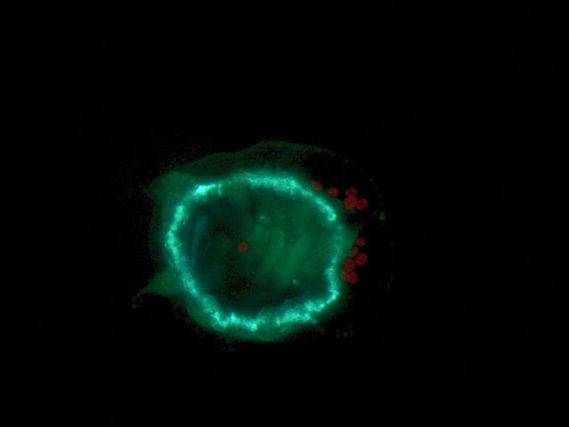 Unknown medusa-like plankton. Picture