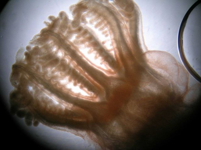 Photograph taken through microscope. Picture