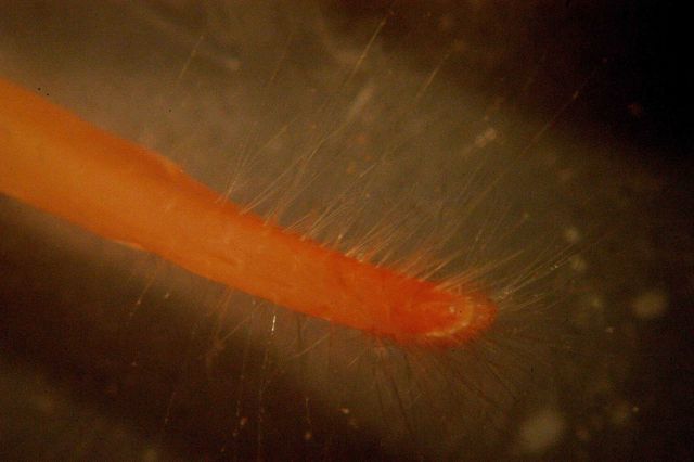 Photograph taken through microscope. Picture