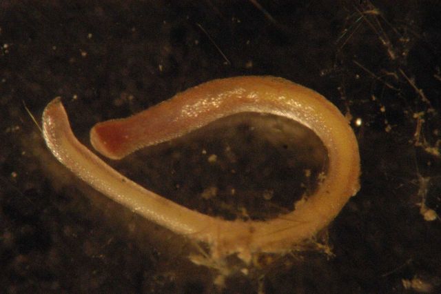 Photograph taken through microscope. Picture