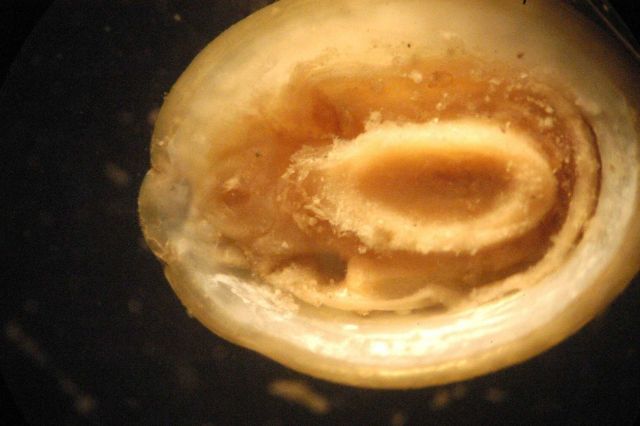 Photograph taken through microscope. Picture