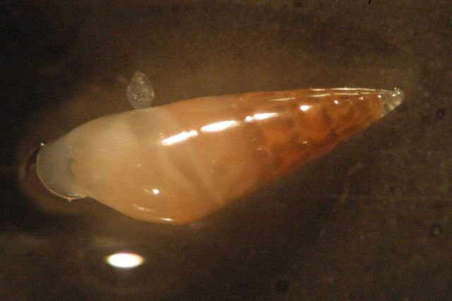 Photograph taken through microscope. Picture