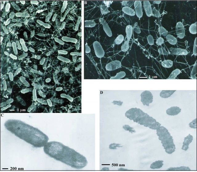 Photomicrographs of a subsea thermophile isolated from deep-sea hydrothermal fluids Picture
