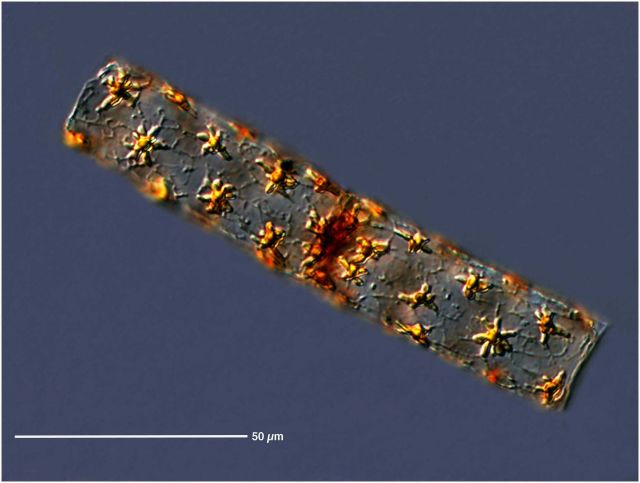 Star stick diatom. Picture