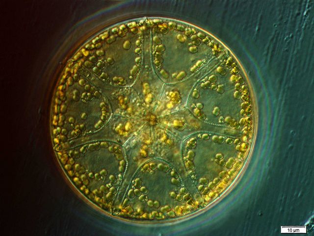 Asterolampra marylandica from the Bay of Villefranche. Picture