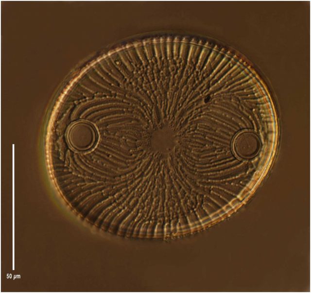 Auliscus sculptus from the Bay of Villefranche. Picture