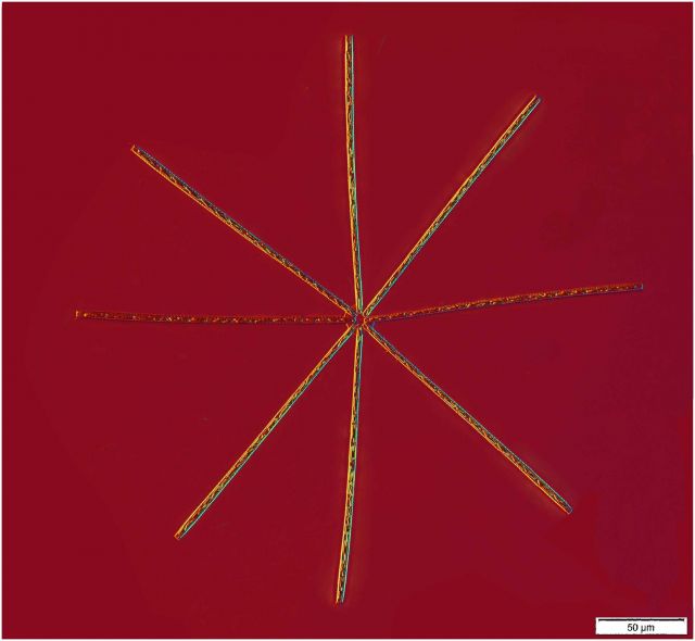 Stick star diatom Picture