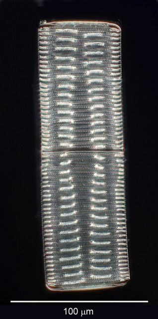 Diatom tower found in the Bay of Villefranche. Picture
