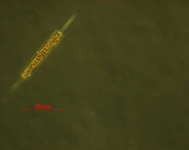 Ditylum brightwellii - live specimen Picture