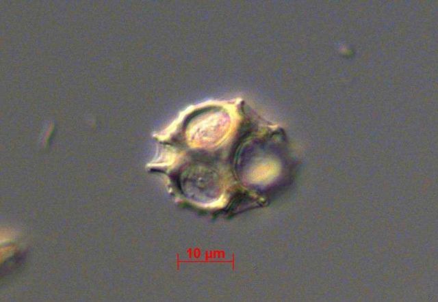 Ebria sp Picture