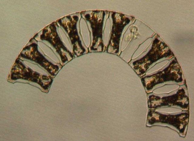 Eucampia zoodiacus preserved by lugol solution Picture