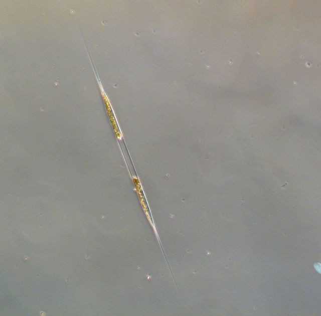 Rhizsolenia setigera - live specimen Picture