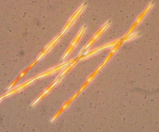 Harmful algae Pseudo-nitzschia Picture