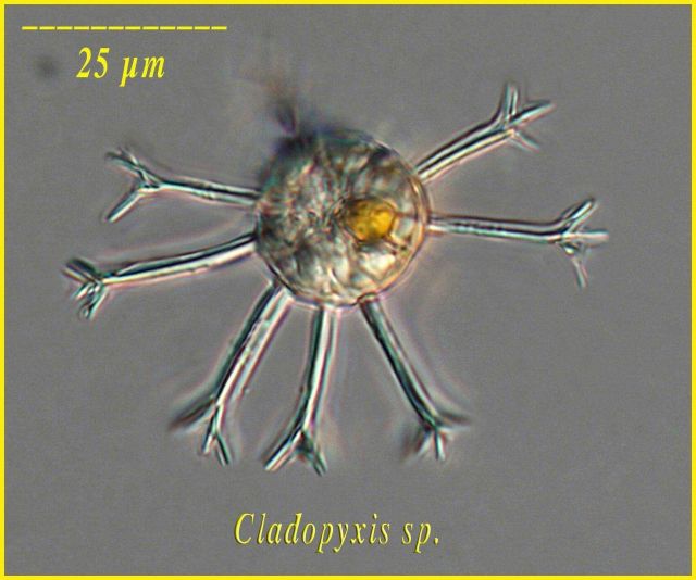 Cladopyxis sp Picture