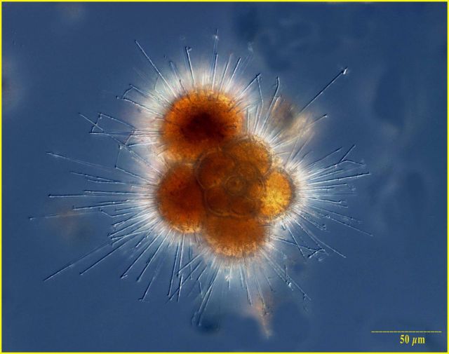 Globigerinid Foramaniferan Picture