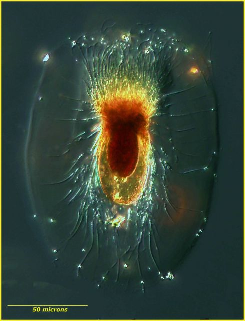 Unidentified planktonic protist Picture