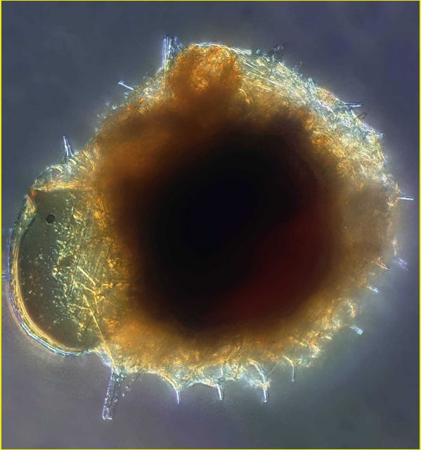 Radiolarian ate the tintinnid Proplectella Picture