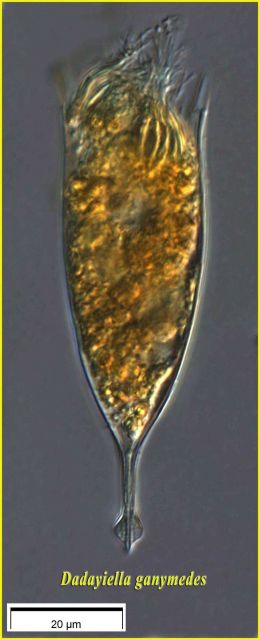 Dadayiella ganymedes - From the Indian Ocean collected during the Tara Oceans Expedition at Station 58, DCM, image using 60X objective Picture