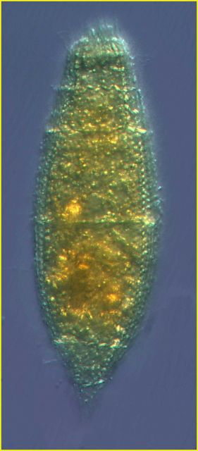 Tiarina fusus - The mouth end of this marine ciliate is at the top Picture