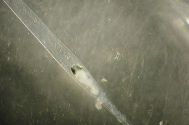 Zooplankton. Picture