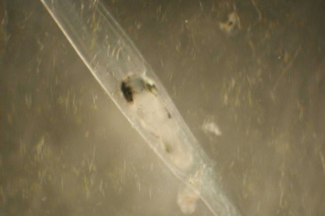 Zooplankton. Picture