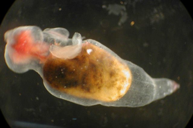 Zooplankton Picture
