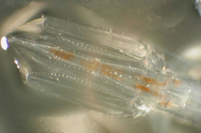 Zooplankton Picture