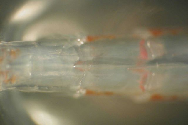 Zooplankton Picture