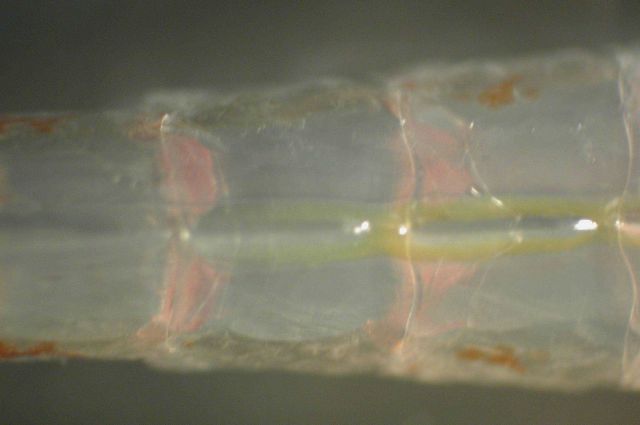 Zooplankton Picture