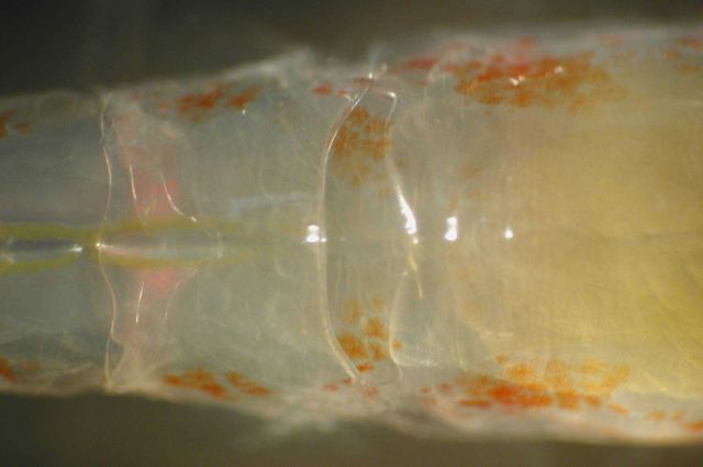 Zooplankton Picture