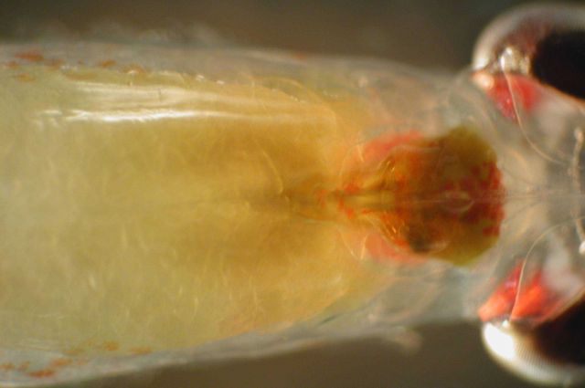 Zooplankton Picture