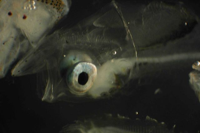 Zooplankton Picture
