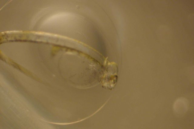 Zooplankton Picture