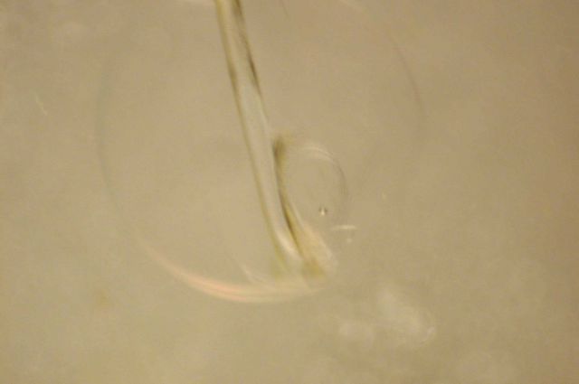 Zooplankton Picture