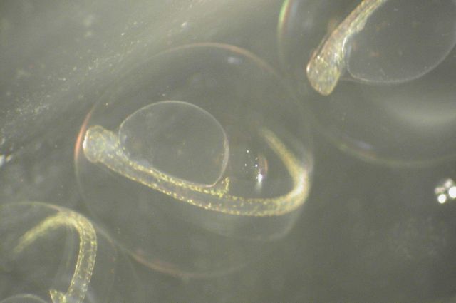 Zooplankton Picture