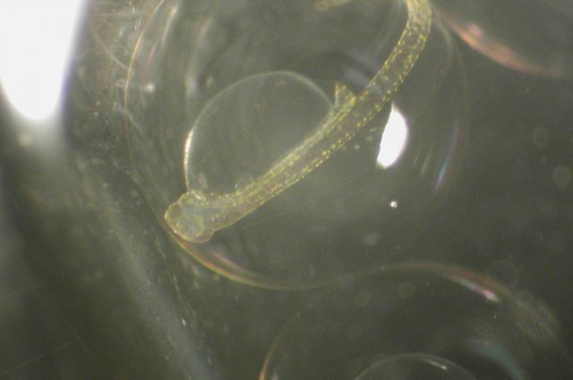Zooplankton Picture