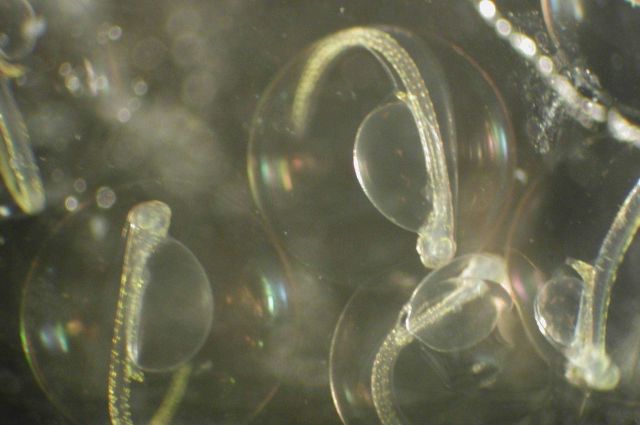 Zooplankton Picture