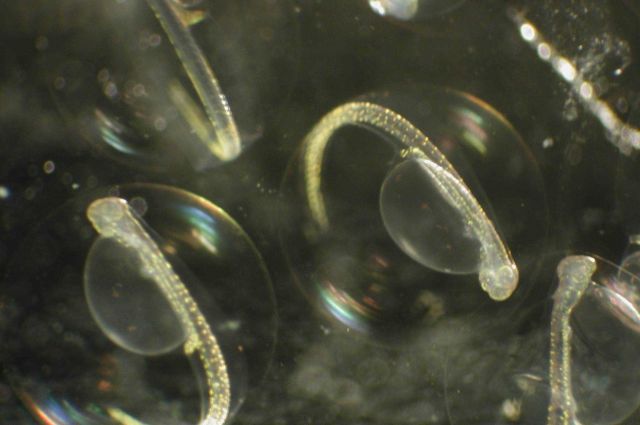 Zooplankton Picture