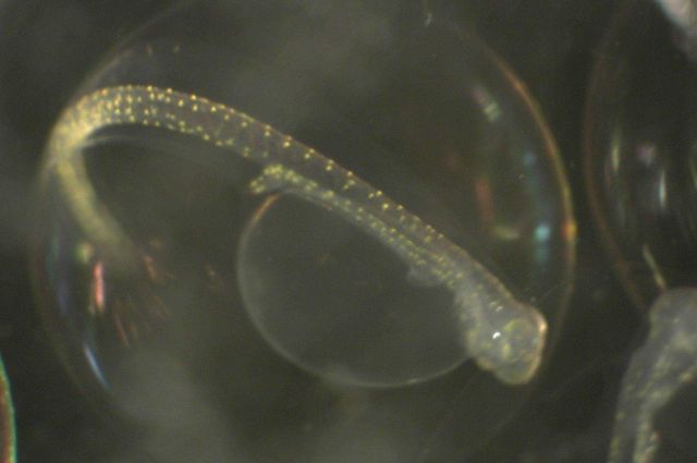 Zooplankton Picture