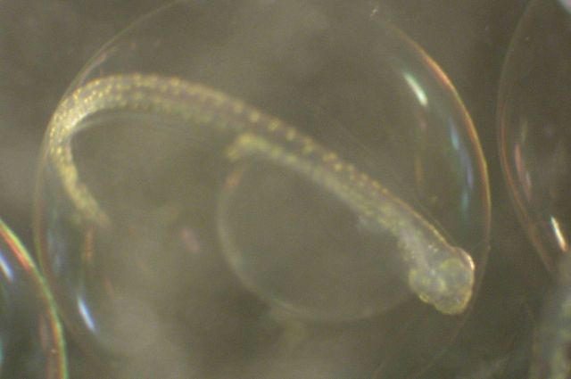 Zooplankton Picture