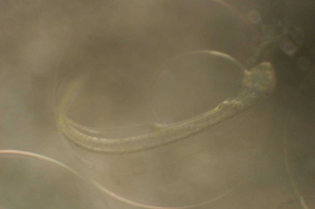 Zooplankton Picture