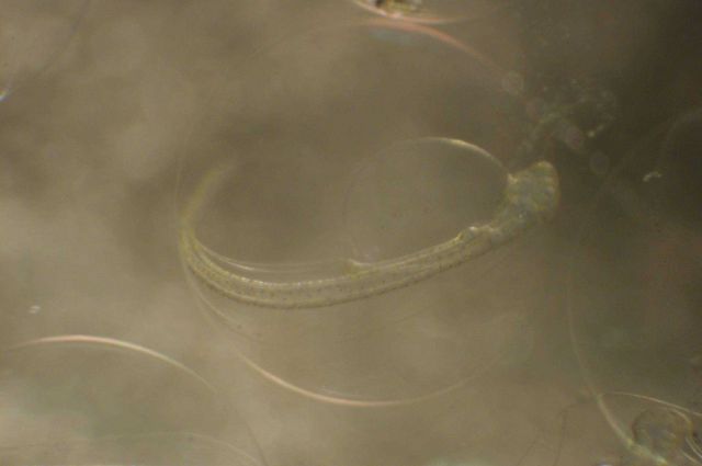 Zooplankton Picture