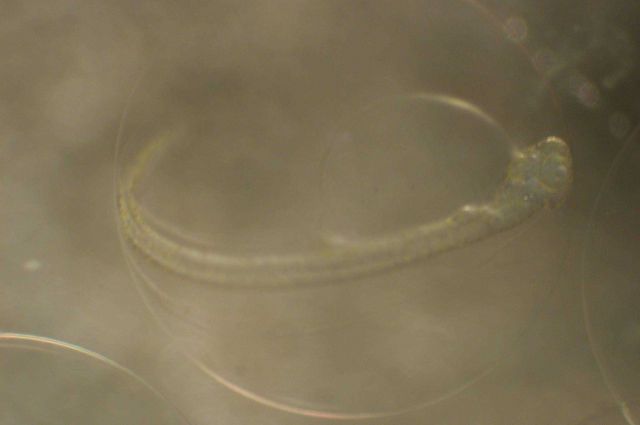 Zooplankton Picture