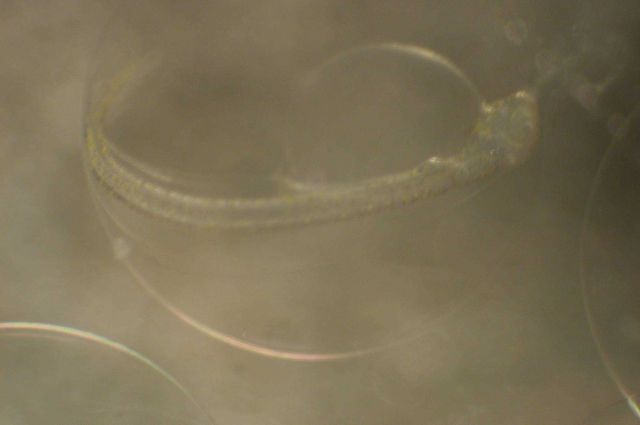 Zooplankton Picture