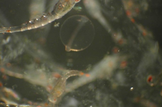 Zooplankton Picture