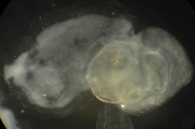 Zooplankton. Picture
