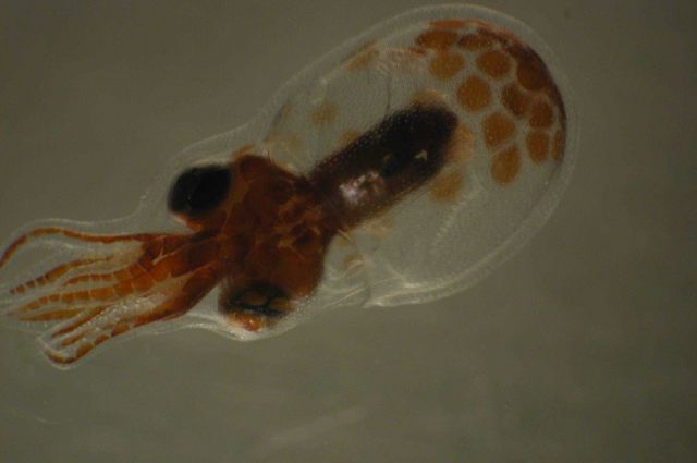 Zooplankton Picture