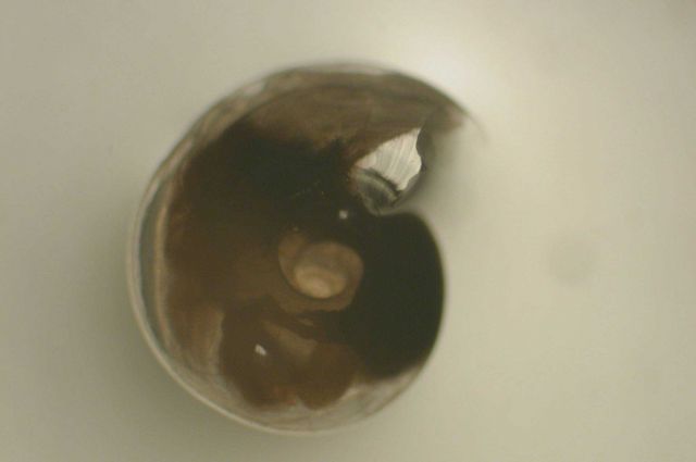 Zooplankton Picture